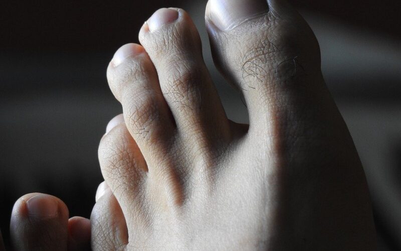 Nepříjemný zápach nohou může způsobit i vážná choroba
